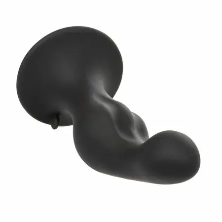 CalExotics Silicone Anal Ripple Kit - 3-Piece Graduated Set with Suction Base